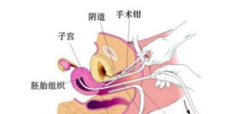 短效避孕药怎么吃 吃短效避孕药对月经有好处吗