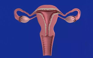 得了子宫肌瘤一定要手术吗 什么情况下子宫肌瘤需要手术