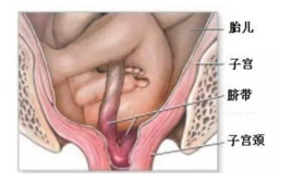 孕妇破水后能走路吗 孕妇破水后怎么走路最安全