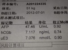 唐筛结果看男孩女孩靠谱吗 唐筛结果怎么看男女