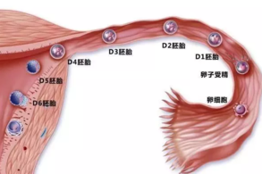 宫外孕手术后多久能怀孕 宫外孕手术后什么时候备孕