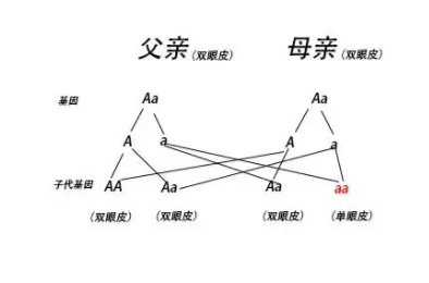 双眼皮父母会生出单眼皮孩子吗 单眼皮孩子概率大吗