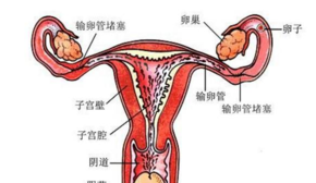 输卵管堵塞食疗方法有用吗 输卵管堵塞食疗食谱