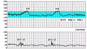 胎心率看胎儿性别有用吗 怎么从胎心率看胎儿的性别
