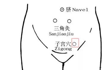 艾灸能助孕是真的吗 艾灸助孕部位图示