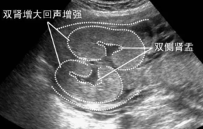 2019年2月8生男生女 农历正月初四怀孕生男孩还是女孩