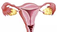 卵巢多囊样改变怎么治疗 卵巢多囊样改变会影响怀孕吗