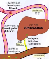 新生儿黄疸怎么退得快 哪些孩子容易得黄疸