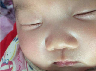新生儿鼻子上的白点是什么 新生儿鼻子上的白点怎么处理