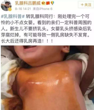 新生儿乳头需要挤吗 给新生儿挤乳头的危害