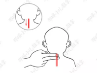 孩子舌苔白、厚、腻怎么推拿 孩子舌苔厚推拿手法