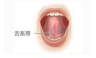 舌系带过短治疗的黄金时间 舌系带过短会带来什么问题