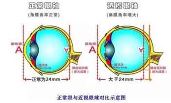 保护孩子视力要注意哪些事情 孩子视力平时保护方法