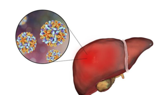 乙肝患者为什么要定期做B超 从乙肝发展从肝癌要多久时间