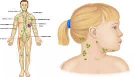 小孩淋巴结肿大怎么办 小孩淋巴结肿大危险吗