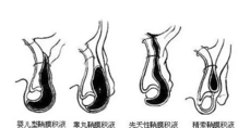 宝宝蛋蛋有积液怎么办 蛋蛋有积液治疗方法