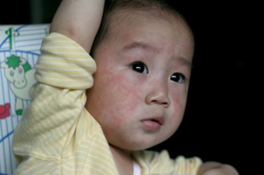 幼儿急疹护理方法 如何判断是否是幼儿急疹