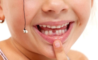 孩子乳牙滞留要拔掉吗 孩子乳牙滞留的常见原因