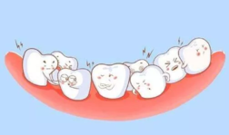 孩子有烂牙是怎么回事 为什么孩子的牙齿容易坏