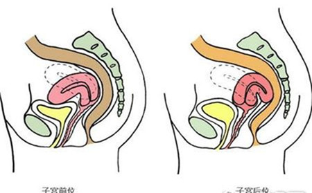 子宫前位是男孩吗 子宫前位生男孩比例子宫前位有什么危害